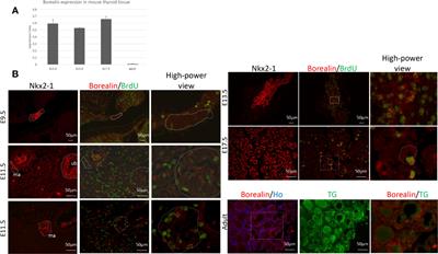 Borealin/CDCA8 deficiency alters thyroid development and results in papillary tumor-like structures